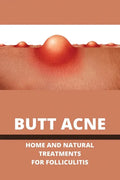Butt Acne: Home And Natural Treatments For Folliculitis: Barber'S Itch Home Remedies - Paperback