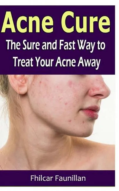 Acne Cure: The Sure and Fast Way to Treat Your Acne Away - Paperback