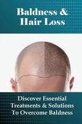 Baldness & Hair Loss: Discover Essential Treatments & Solutions To Overcome Baldness: How To Prevent Hair Loss For Guys - Paperback